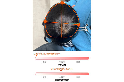 頭の測定イメージ